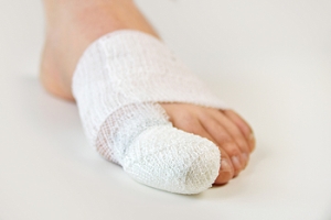 All About Broken Toes